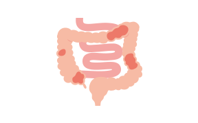 大腸型