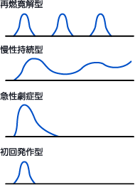 臨床経過による4分類